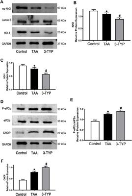 SIRT3 inhibitor 3-TYP exacerbates thioacetamide-induced hepatic injury in mice